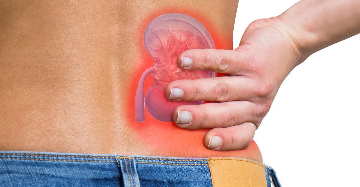 Woman-touching-back-in-pain-from-kidney-stones